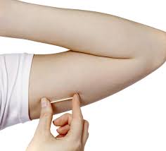implants